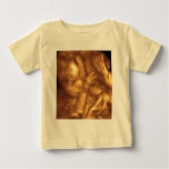 4D Ultrasound t-shirts