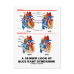 A Closer Look At Blue Baby Syndrome (Heart) Postcards