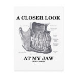 A Closer Look At My Jaw (Anatomical Bones)