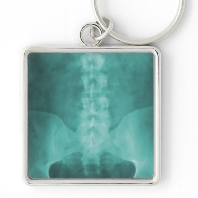 Aqua Digital X-Ray Art Keychain by chiropracticbydesign