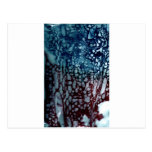 Arctic Exsanguination Postcard