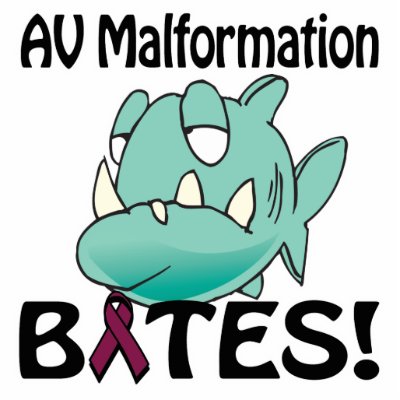 AV Malformation BITES Photo Sculpture by super_shop
