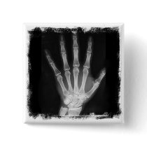B&W X-ray Skeleton Hand