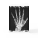 B&W X-ray Skeleton Hand cards