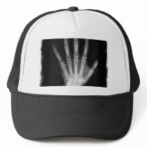 B&W X-ray Skeleton Hand