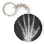 B&W X-ray Skeleton Hand