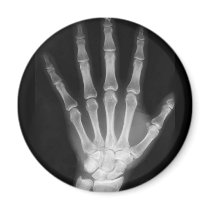 B&W X-ray Skeleton Hand