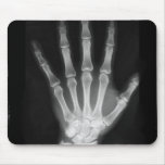 B&W X-ray Skeleton Hand