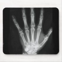 B&W X-ray Skeleton Hand