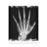 B&W X-ray Skeleton Hand postcards