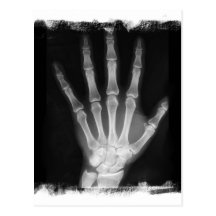 B&W X-ray Skeleton Hand Postcard
