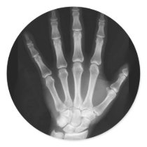 B&W X-ray Skeleton Hand