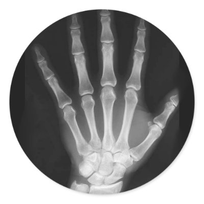 B&W X-ray Skeleton Hand by VoXeeD