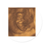 baby 3d 11 weeks stickers