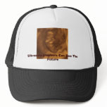 baby 3d 11 weeks, Ultrasonographers Can See The... Hat
