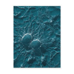 Bacterial cells of Staphylococcus Aureus Close Up postcards