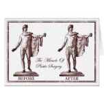 Before and After