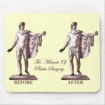 Before and After