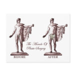 Before and After