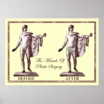 Before and After