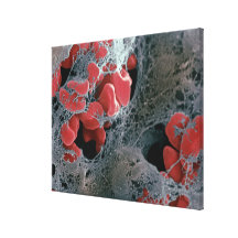 Blood Clot 2 Stretched Canvas Print