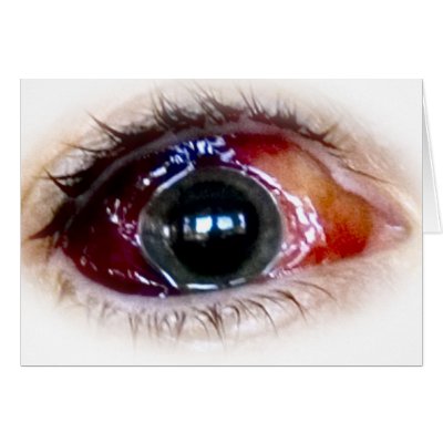 Blood shot greeting card by VictorDiCara