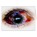 Blood shot cards