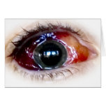 Blood shot cards