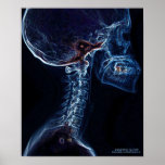 Blue C-spine X-ray poster