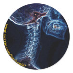 Blue C-spine X-ray sticker