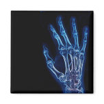 Blue Hand X-ray magnet