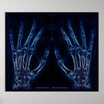 Blue Hands X-ray poster