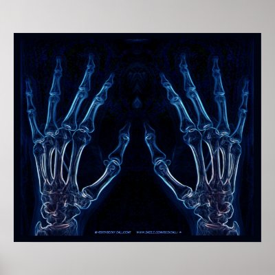 Blue Hands X-ray poster by BeckCalli
