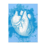 Blue Heart with Spatters postcards