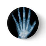 Blue X-ray Skeleton Hand