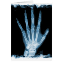 Blue X-ray Skeleton Hand