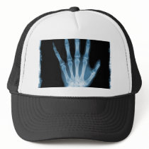 Blue X-ray Skeleton Hand
