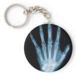 Blue X-ray Skeleton Hand Key Chains