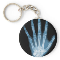 Blue X-ray Skeleton Hand