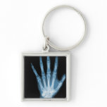Blue X-ray Skeleton Hand