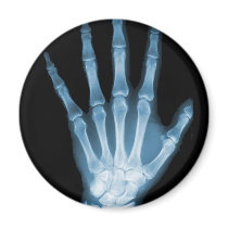 Blue X-ray Skeleton Hand