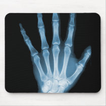 Blue X-ray Skeleton Hand