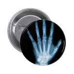 Blue X-ray Skeleton Hand Pinback Button