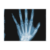 Blue X-ray Skeleton Hand