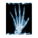 Blue X-ray Skeleton Hand Postcard