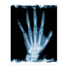 Blue X-ray Skeleton Hand Postcard