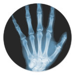Blue X-ray Skeleton Hand