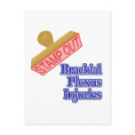 Brachial Plexus Injuries
