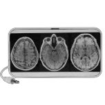 Brainophonic speakers