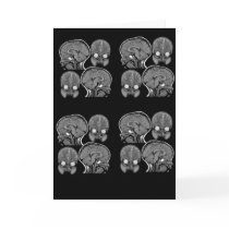BRAINS! (MRI) GREETING CARDS